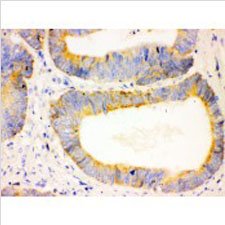 Anti-Collagen, Type IV Mouse Monoclonal Antibody