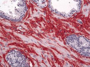 Anti-COL1A1 Mouse Monoclonal Antibody