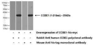 Anti-CCBE1 Rabbit Polyclonal Antibody