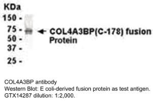 Anti-COL4A3BP Chicken Polyclonal Antibody