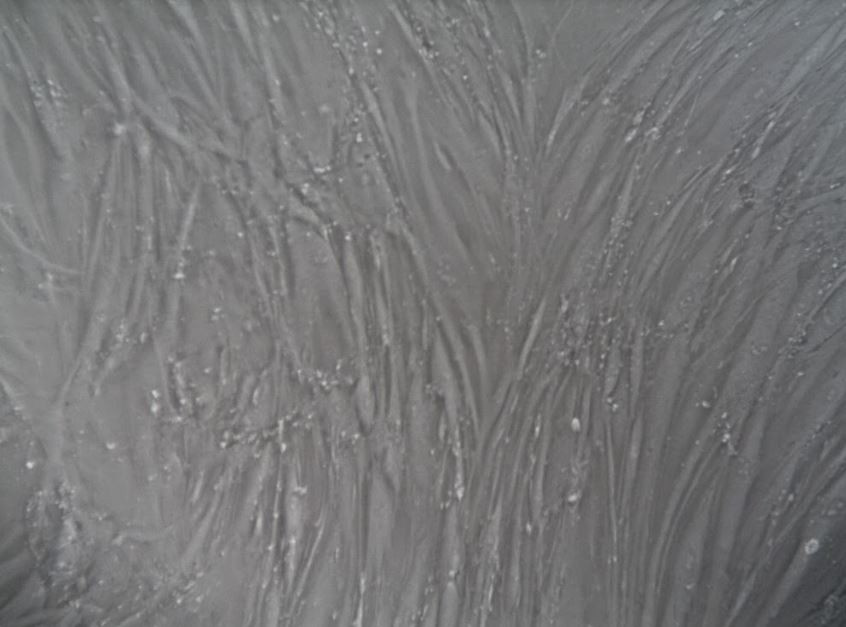 Immortalized Human Lung Adenocarcinoma Cancer-Associated Fibroblasts
